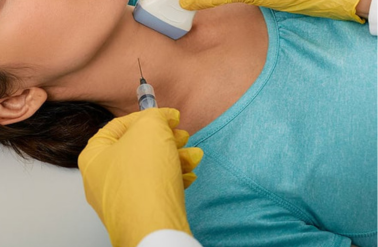 ago aspirato battipaglia